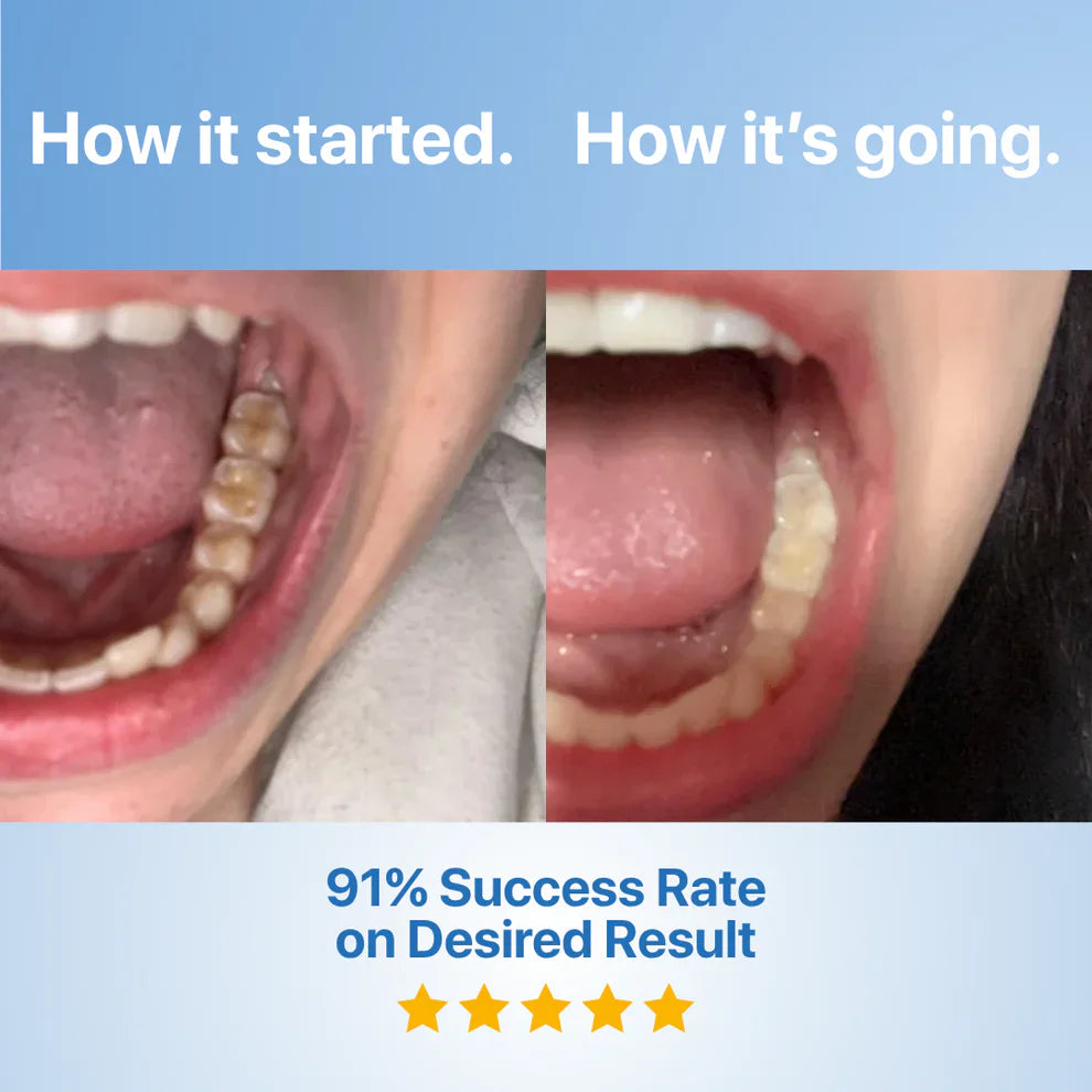 QIAWI Fluoride-Free Hydroxyapatite Tooth Armor Essence & Enamel Repair
